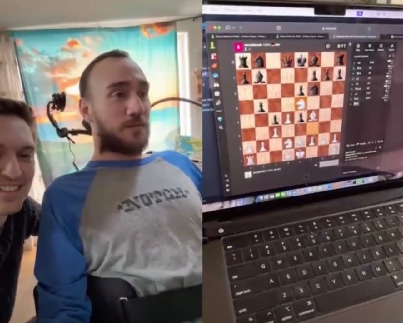 Grazie al chip di Neuralink un paziente tetraplegico gioca a scacchi con il pensiero &#8211; IL VIDEO